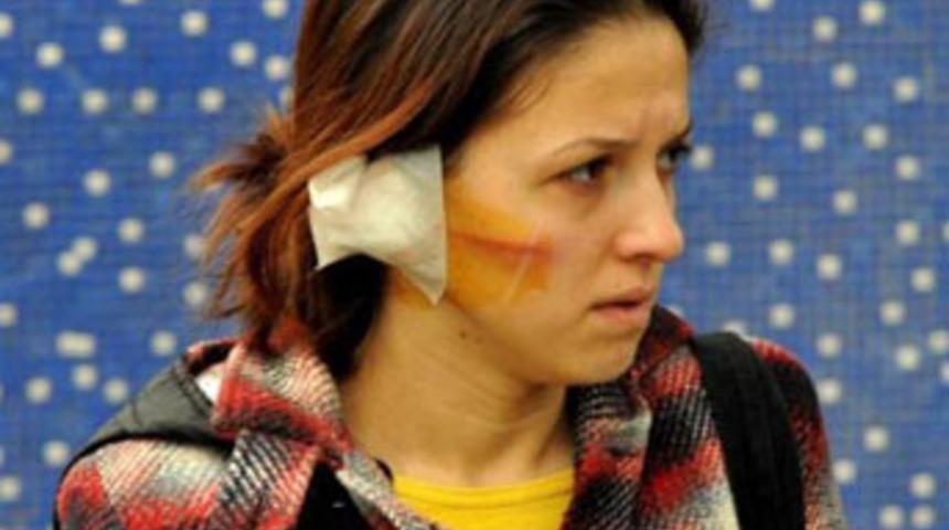 Minib&uuml;s bekleyen kadını d&ouml;vd&uuml;