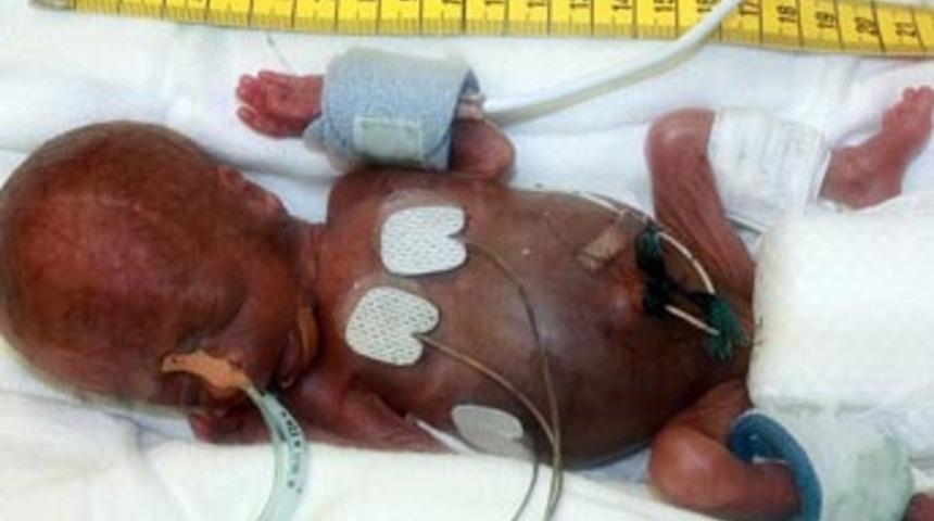 D&uuml;nyanın en k&uuml;&ccedil;&uuml;k bebeği