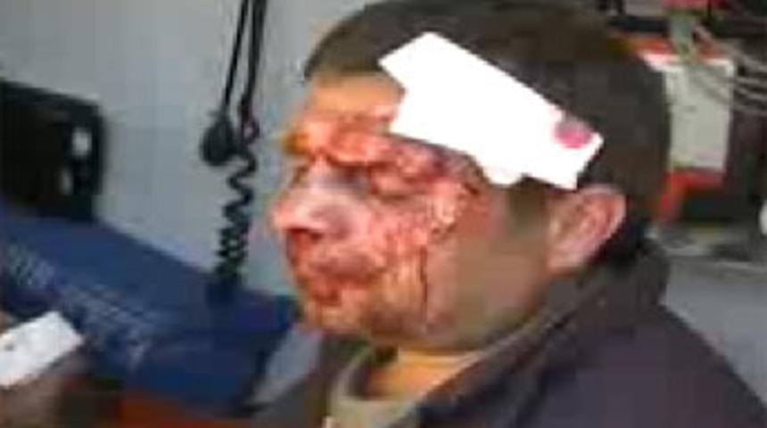 Kaza sonrası birbirlerine girdiler