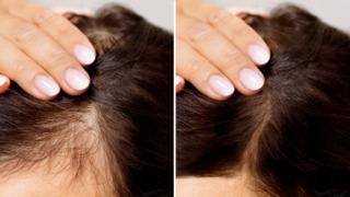 Bu 3 yağ saçları inanılmaz gürleştiriyor! Saçlarınız sürekli dökülüyorsa artık dert değil