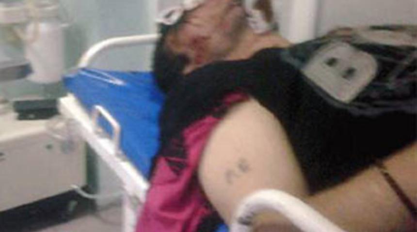 Tinerci Emrah&rsquo;ı benzin d&ouml;k&uuml;p yaktılar