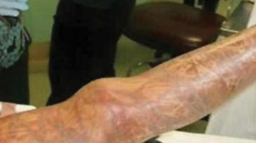 Tıpta ezber bozan olay!