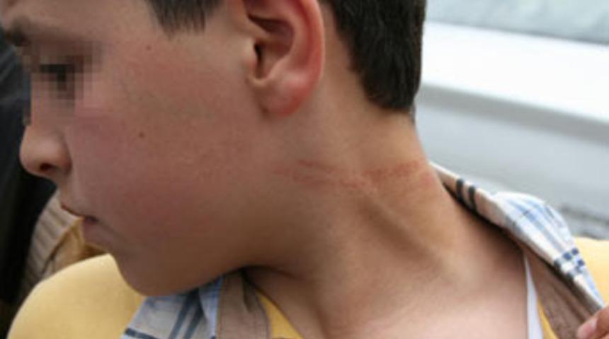 "&Ouml;ğretmen kafamızı duvara vuruyor"