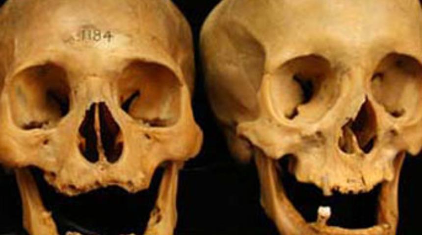 Neden estetik y&uuml;z&uuml; gen&ccedil;leştiremiyor?