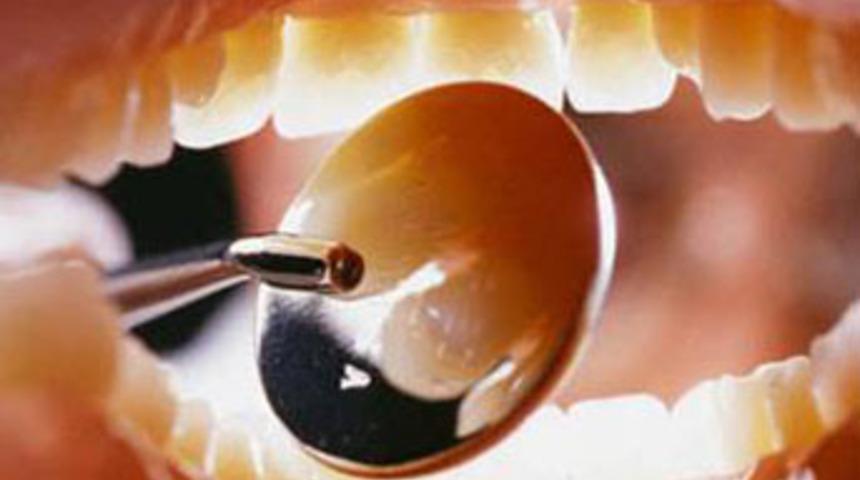 Kalp krizi sinyali ağızda başlıyor