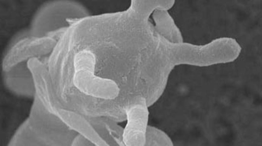 &Ouml;l&uuml;mc&uuml;l hastalık hızla yayılıyor