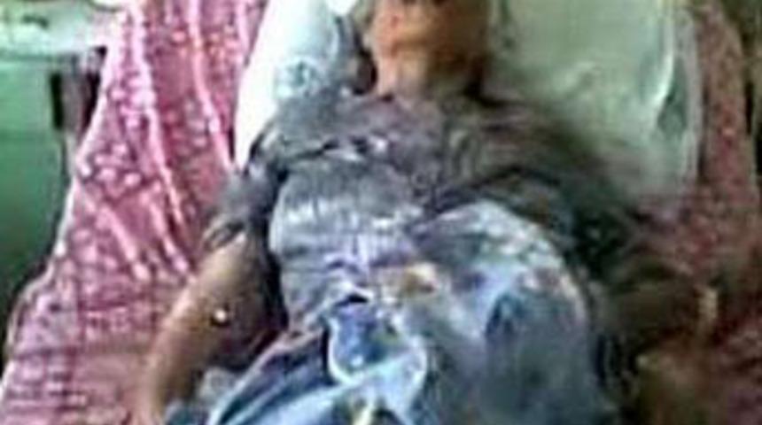 Acile gitti, 3 organından oldu