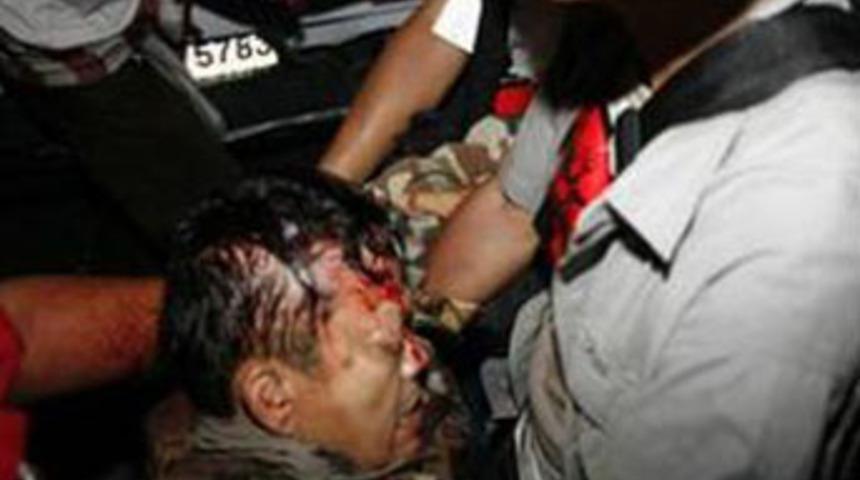 R&ouml;portaj sırasında vuruldu