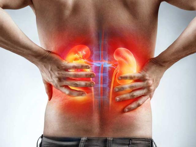 Uzmanı uyardı: İhmal etmeyin, b&ouml;brek kaybına yol a&ccedil;ıyor!