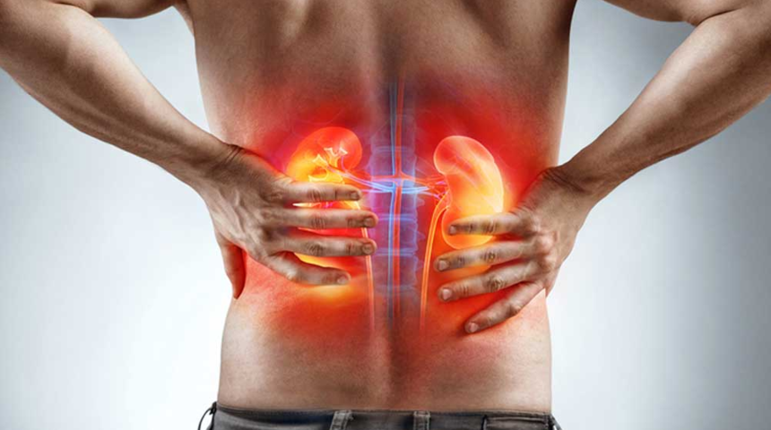 Türkiye’de her 7 kişiden birini buluyor: Dünya’da 800 milyona yakın böbrek hastası var