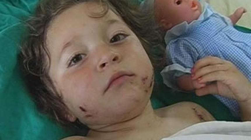 K&ouml;pek, 4 yaşındaki kızı &ouml;ld&uuml;r&uuml;yordu