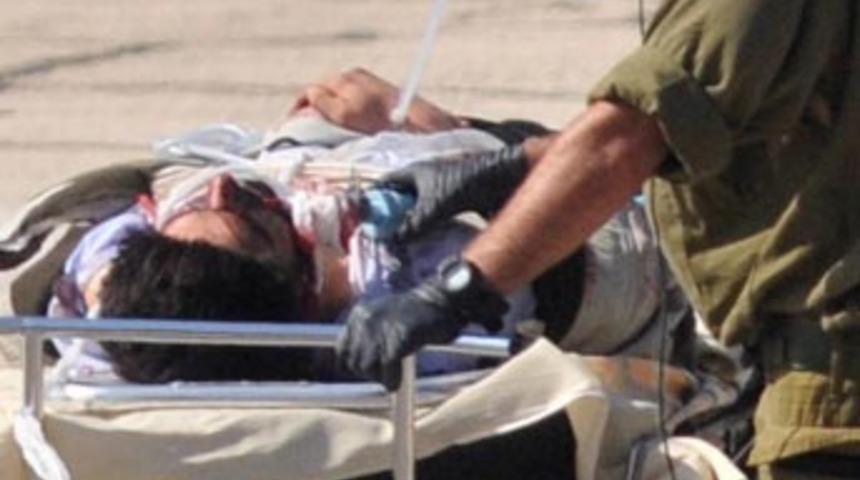 Ağır yaralıları bile kelep&ccedil;elediler