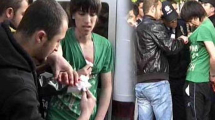 Yaralıya kelep&ccedil;eli m&uuml;dahale!