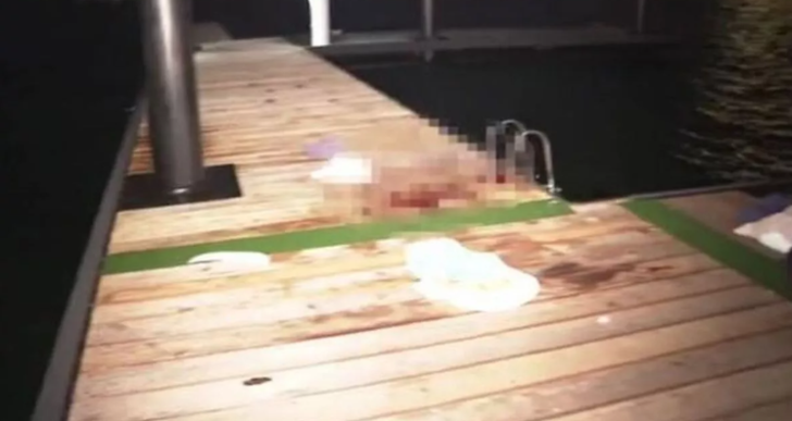 Su bir anda kana bulandı! Hiçbir şeyden habersiz yüzen kadına köpek balığı saldırdı... Doktorlar açıkladı:Durumu kritik G2