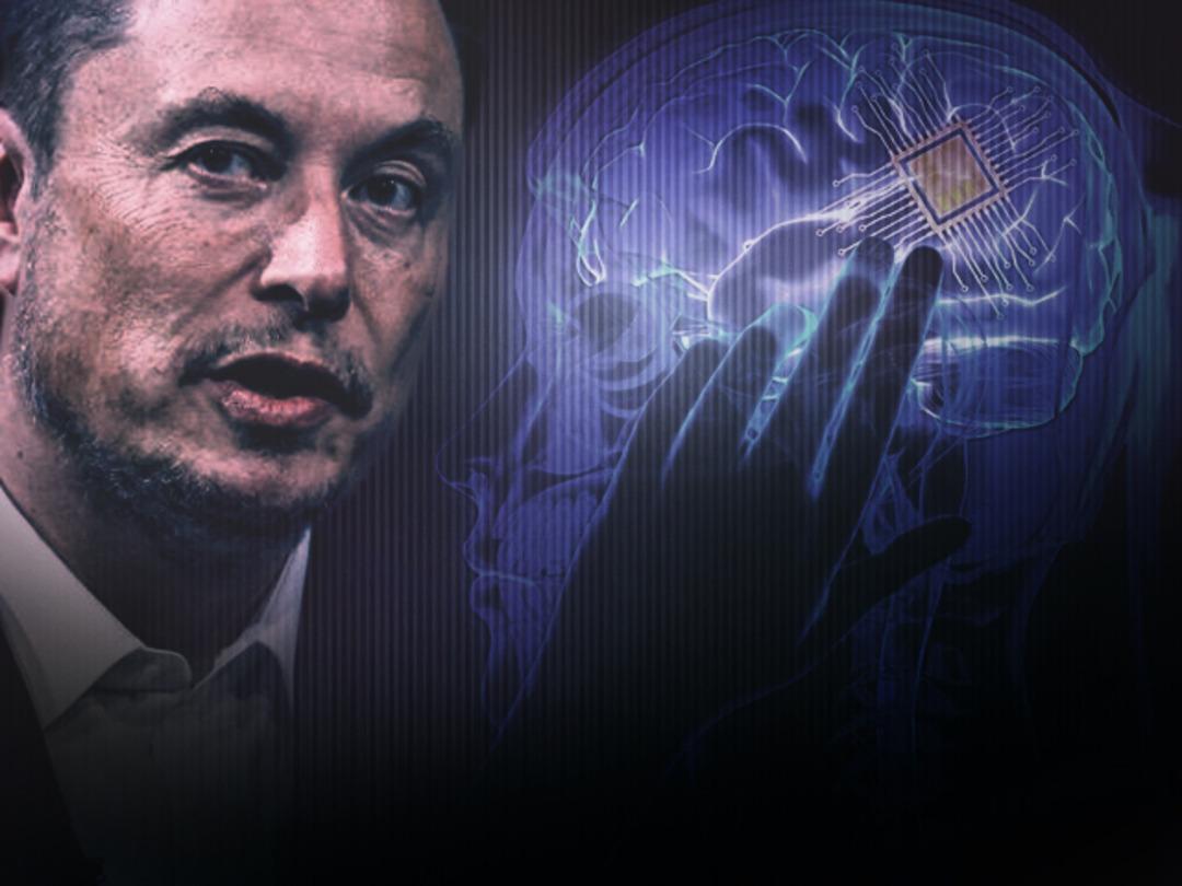Elon Musk beynimizde: 'İlk cyborg doğdu!' Neuralink insana beyin &ccedil;ipi taktı, sosyal medya dehşet i&ccedil;inde