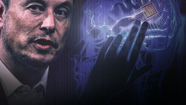 Elon Musk beynimizde: 'İlk cyborg doğdu!' Neuralink insana beyin çipi taktı, sosyal medya dehşet içinde