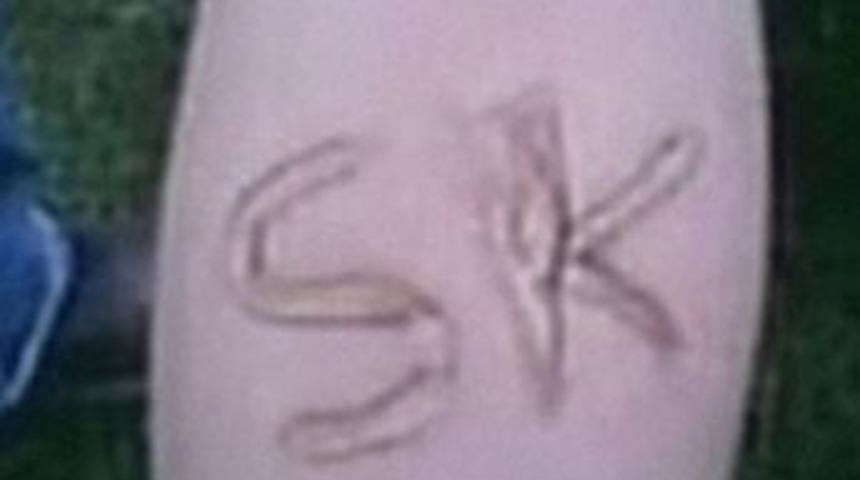 Boşanırken &ccedil;ocuklarını dağladı!