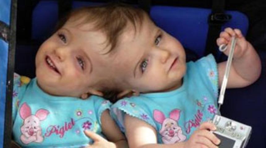 Aynı beyni paylaşıyorlar