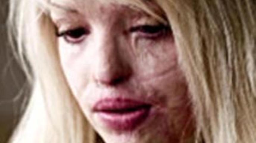 T&uuml;rk doktorun mucizesi