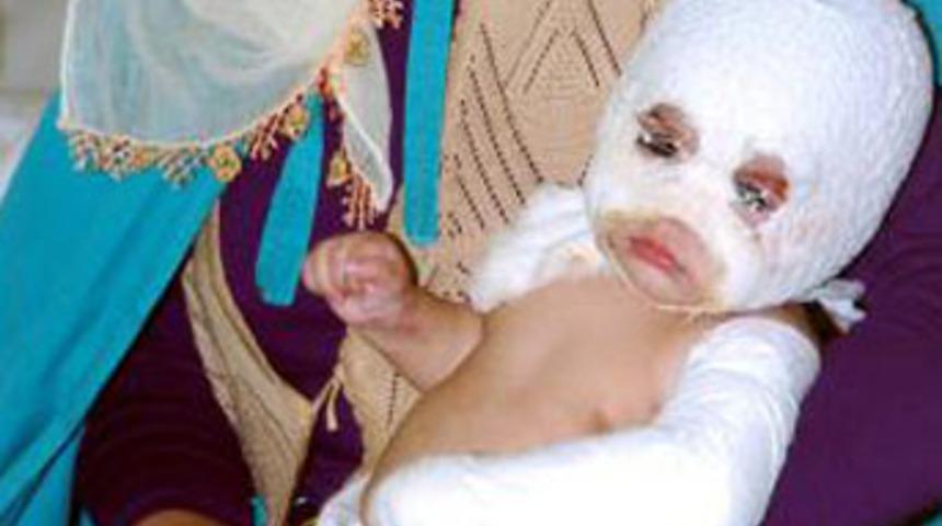 Bebeğini alevlerin arasından kurtardı