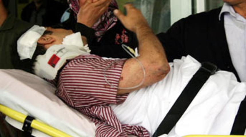 Polisi vuran bombayla aynı d&uuml;zenek