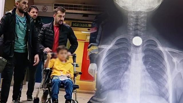 Yer: Bursa! 7 yaşındaki çocuk madeni parayı yuttu, bir anda fenalaştı