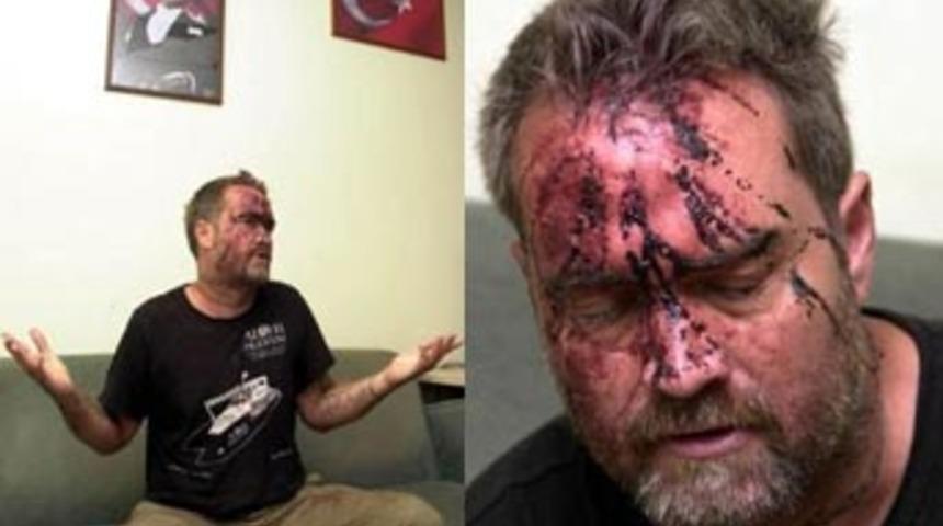 Kan revan i&ccedil;inde İstanbul'a geldi