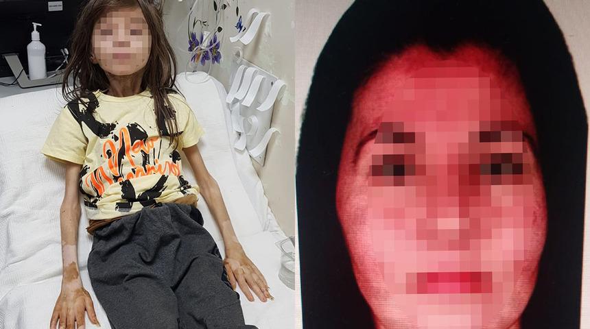 Evde bir deri bir kemik ve içler acısı halde bulunmuştu! Çöp ev skandalında yeğenini kilitleyen teyzeye tahliye