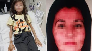 Evde bir deri bir kemik ve içler acısı halde bulunmuştu! Çöp ev skandalında yeğenini kilitleyen teyzeye tahliye