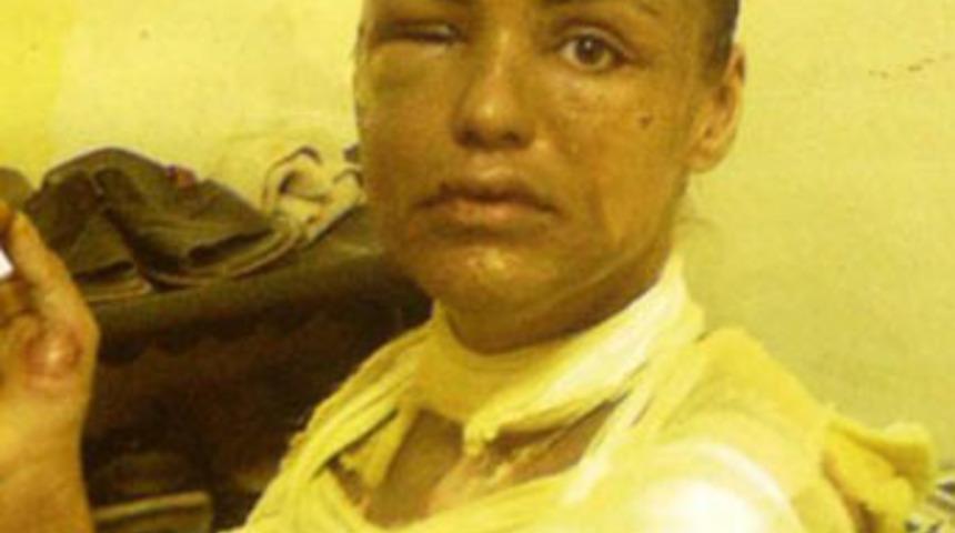 Feci saldırıya 2 yıl 6 ay hapis