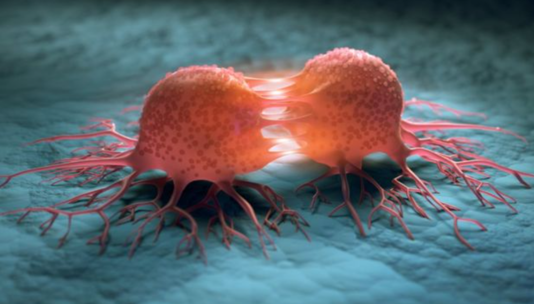 Bu 3 şeyi yapanın kanser riski %61 azalıyor! 3 yıl boyunca denediler... Araştırma sonucu ortaya &ccedil;ıktı