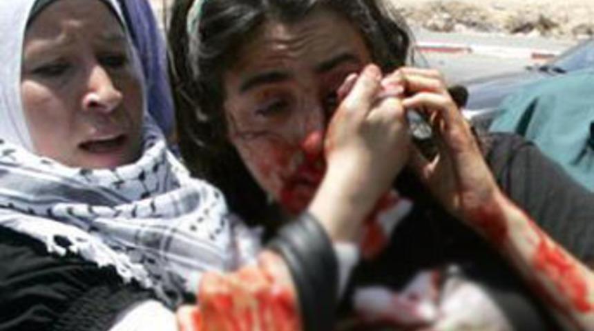 ABD, İsrail'den Emily'nin g&ouml;z&uuml;n&uuml; istiyor