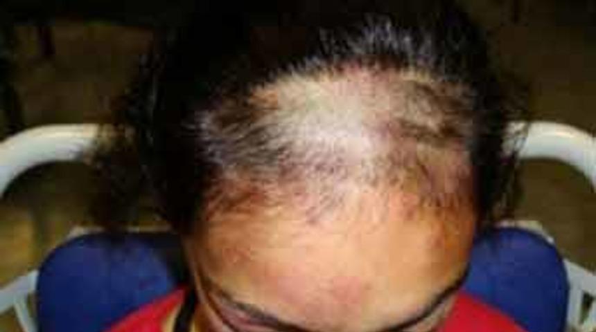 T&uuml;rk kızına 'ırk&ccedil;ı' saldırı