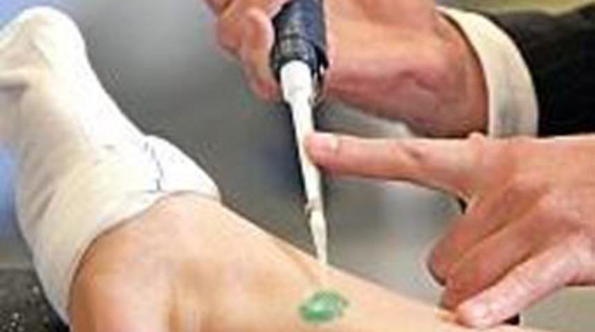 Yaraları hızla iyileştiren mucize jel