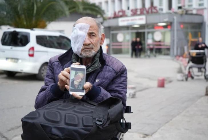 Yüzü eriyen adamın yardım çığlığı: "Suratım mum gibi eriyor, gözüm akıyor" G5