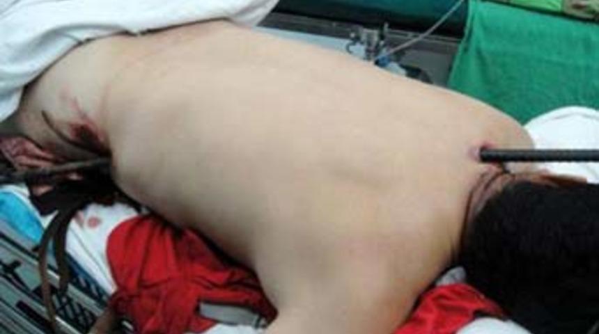 İnanılmaz ama yaşıyor!