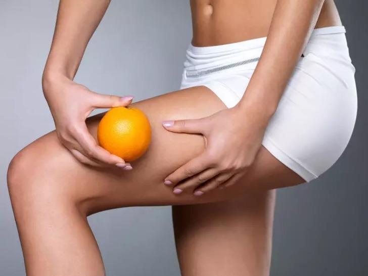 Gardırobunuzu elden geçirmeniz gerekecek! Yanlış kıyafetler selüliti arttırıyor... O yöntem geçirmek yerine daha da kötüleştiriyor  G2