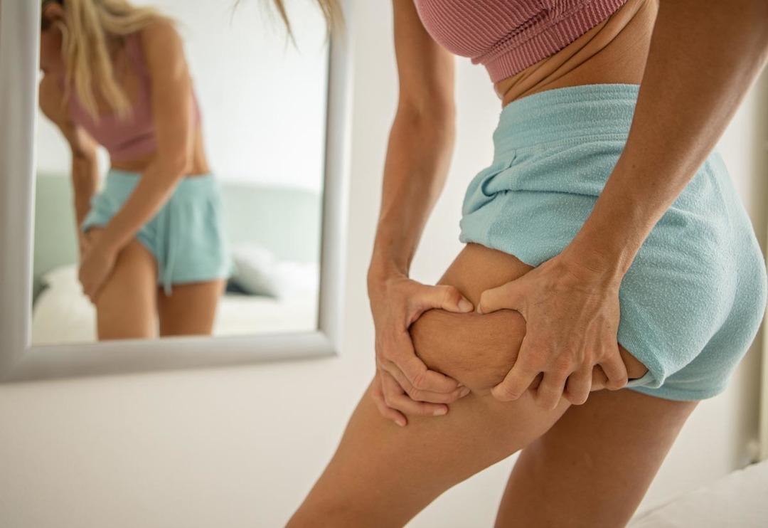 Gardırobunuzu elden ge&ccedil;irmeniz gerekecek! Yanlış kıyafetler sel&uuml;liti arttırıyor... O y&ouml;ntem ge&ccedil;irmek yerine daha da k&ouml;t&uuml;leştiriyor 