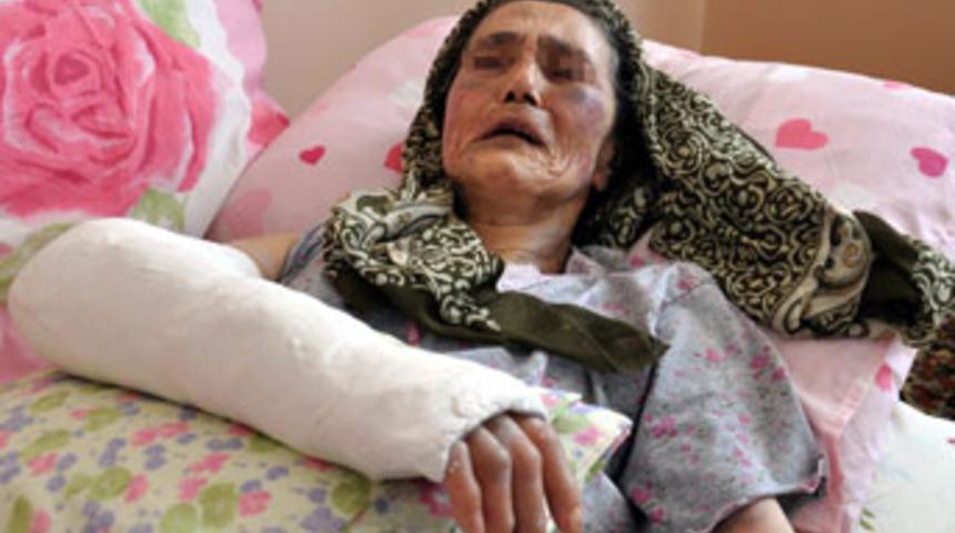 Yaşlı kadını damadı d&ouml;vd&uuml;