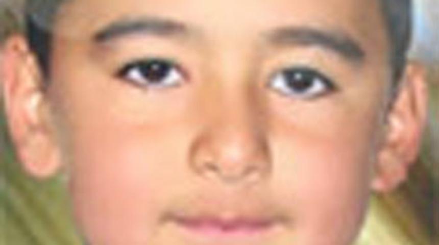 Kas hastasıydı s&uuml;nnet sonu oldu