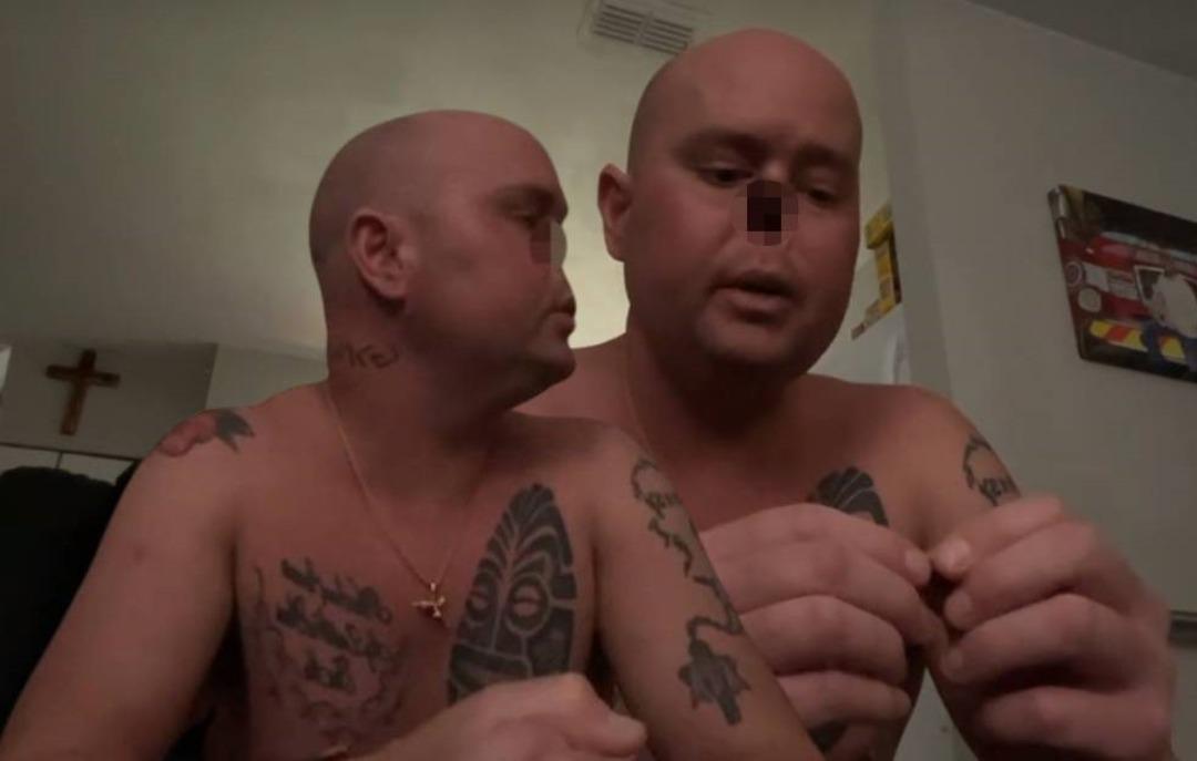 Milyonda iki kişide g&ouml;r&uuml;l&uuml;yor: Grip oldu, burnunu kaybetti! Gen&ccedil; adamın hayatını kaydıran olay