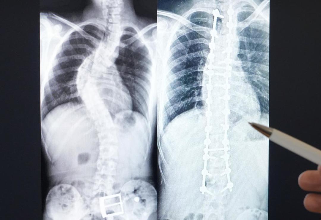 Aileler dikkat! Belirlenmesinde b&uuml;y&uuml;k g&ouml;rev d&uuml;ş&uuml;yor... 