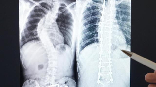 Aileler dikkat! Belirlenmesinde büyük görev düşüyor... 