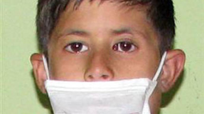 Dudakları s&uuml;rekli b&uuml;y&uuml;yen &ccedil;ocuk