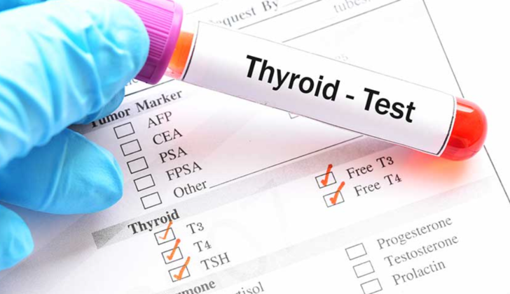TİROİD TESTLERİ
