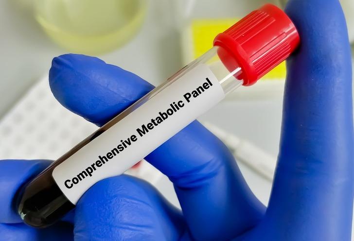 KAPSAMLI METABOLİK PANEL TESTİ