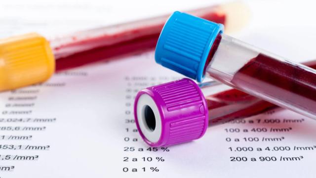 Bu vitamin Alzheimer riskini yüzde 17 düşürüyor! Eğer vücudunuzda eksikse bunama riski yüzde 25 artıyor