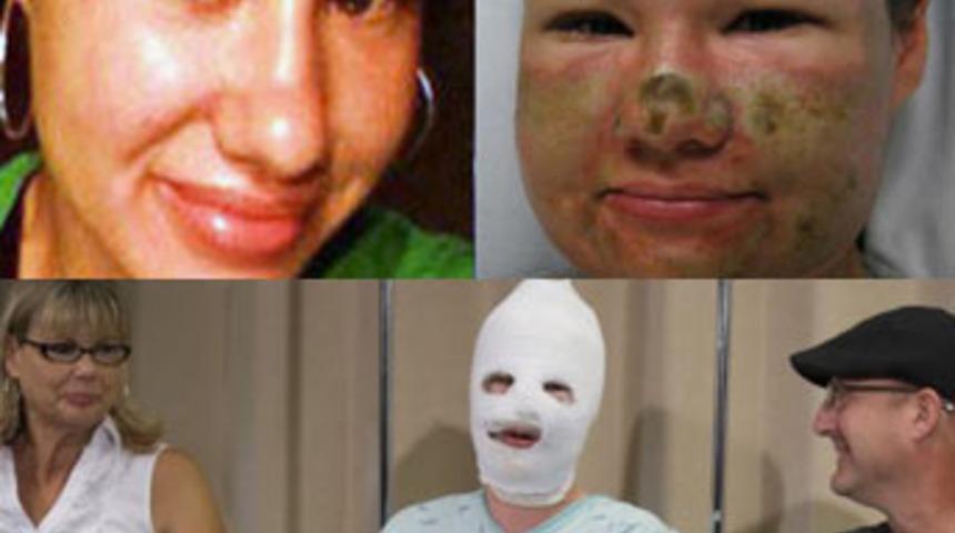 Y&uuml;z&uuml;ne asit d&ouml;kt&uuml;ler!