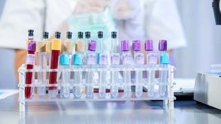 Akılalmaz olay! Dondurucu bozuldu, 1,5 milyar TL çöp oldu