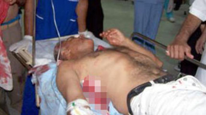 Polis kurşunu ile vuruldu iddiası